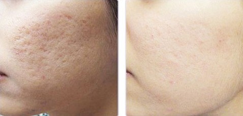 5_14_1339381494_71_tri_seo lan-kim-tri-seo-ro