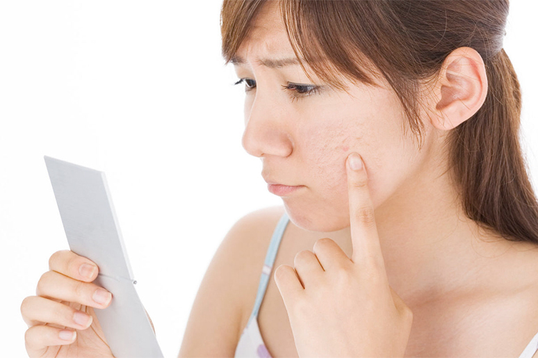 ban-laser-tri-seo-ro-va-seo-tham-co-an-toan-khong-2 trị sẹo thâm bằng laser có an toàn không?