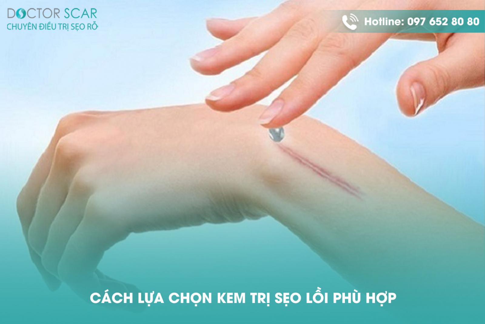 cach-lua-chon-kem-tri-seo-loi-phu-hop Cách lựa chọn kem trị sẹo lồi phù hợp