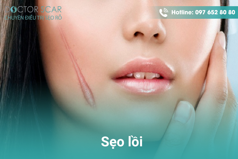 cach-tri-seo-hieu-qua Cách trị sẹo lâu năm.