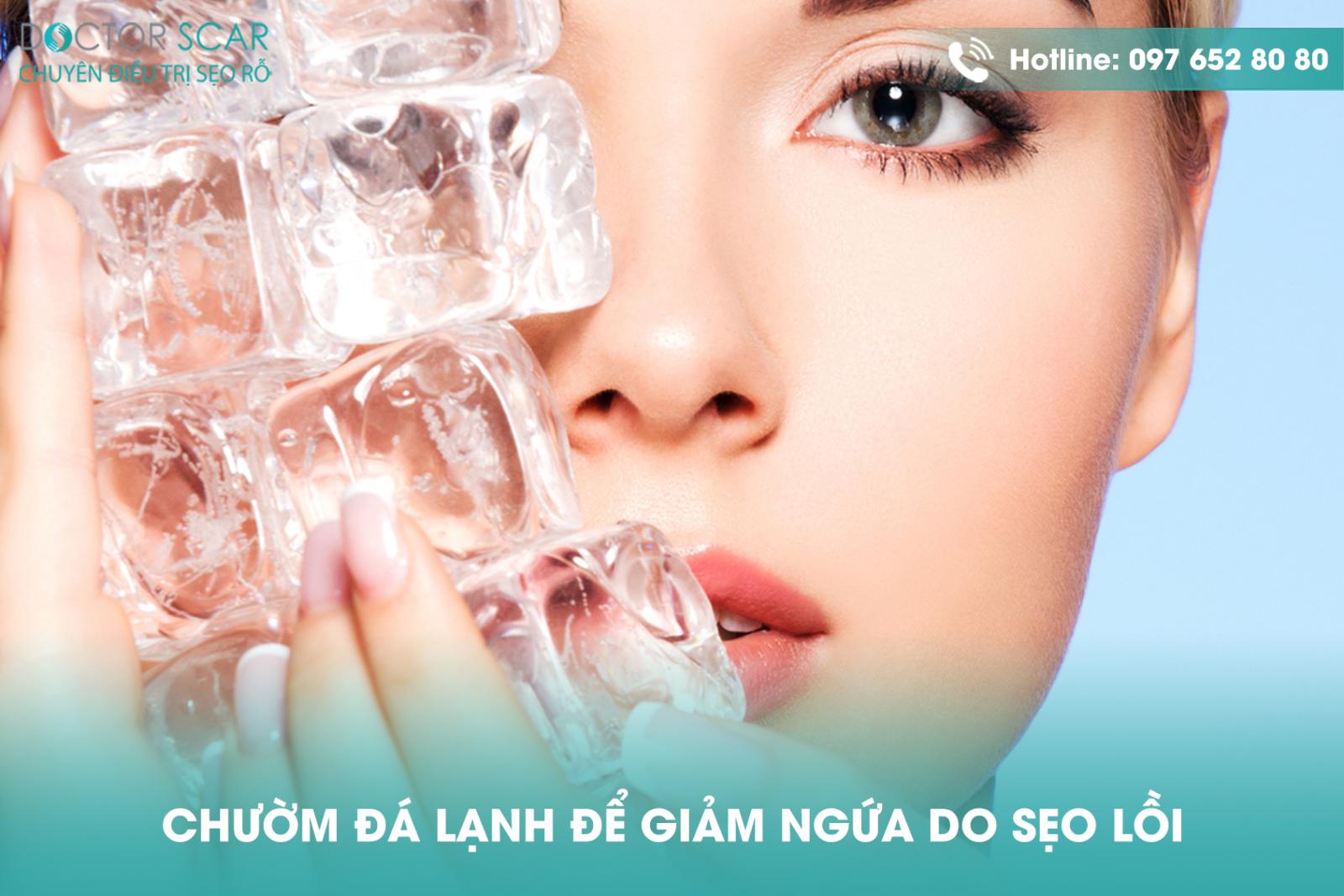 chuom-da-lanh-de-giam-ngua-do-seo-loi Chườm đá lạnh để giảm ngứa do sẹo lồi