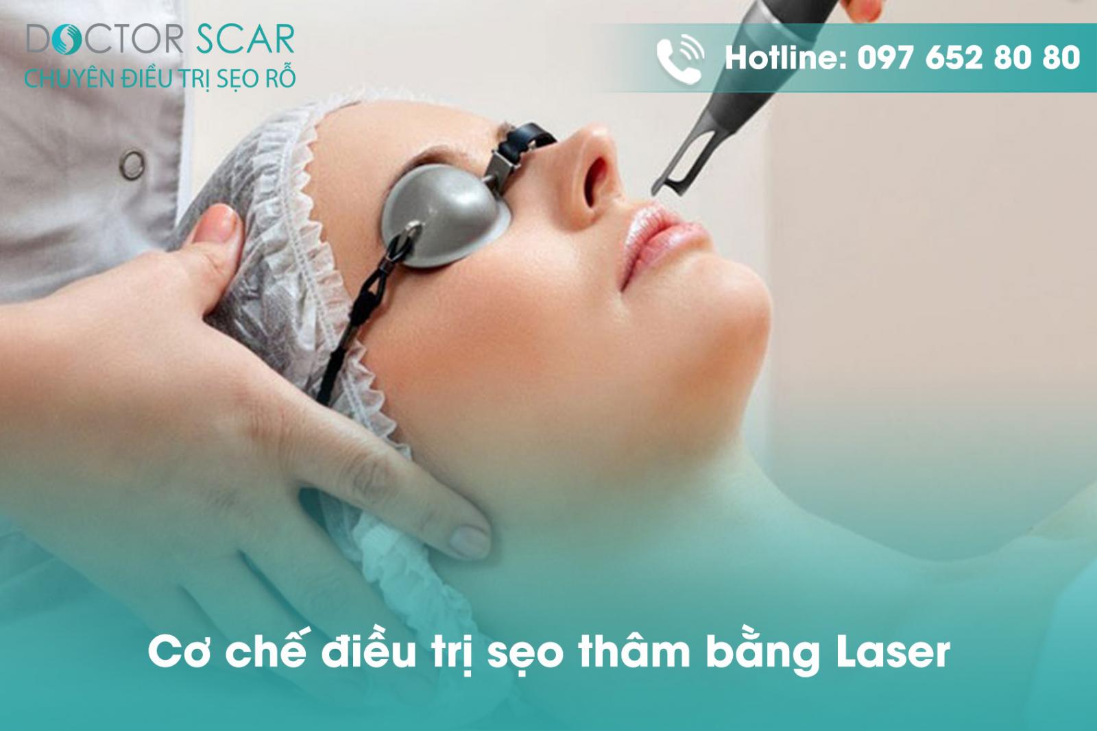 co-che-dieu-tri-seo-tham-bang-laser Cơ chế điều trị sẹo thâm bằng Laser.