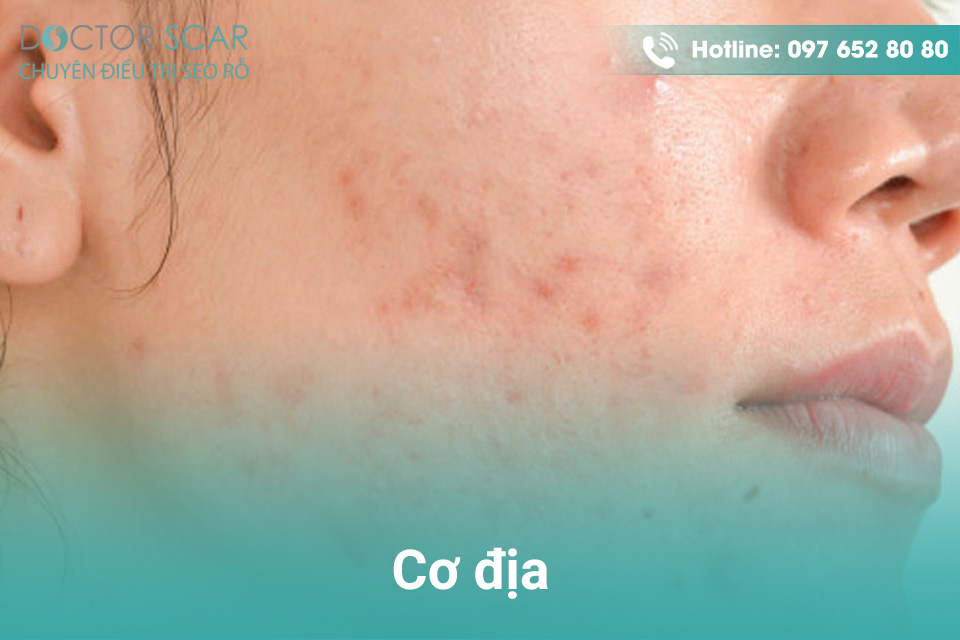 co-dia-nguoi-benh Cơ địa người bệnh.