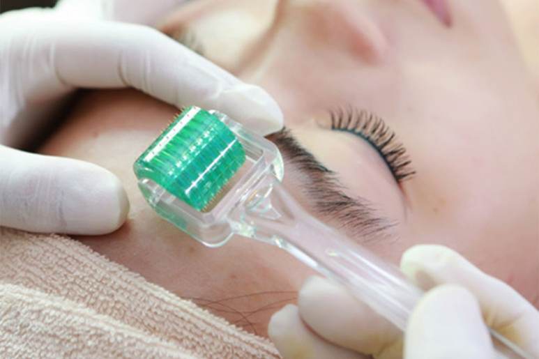 cong-nghe-lan-kim-tri-seo-ro-tot-khong