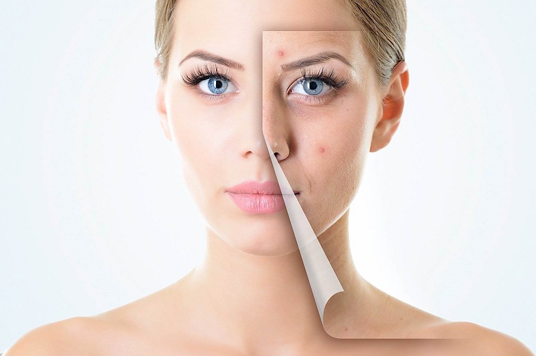 cong-nghe-lan-kim-tri-seo-ro-tot-khong202