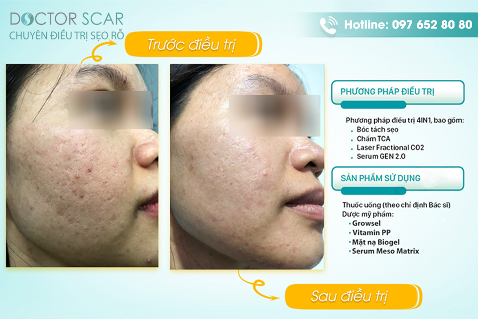 dieu-tri-seo-hieu-qua-tai-phong-kham-doctor-scar Trình độ chuyên môn bác sĩ tại Doctor Scar.