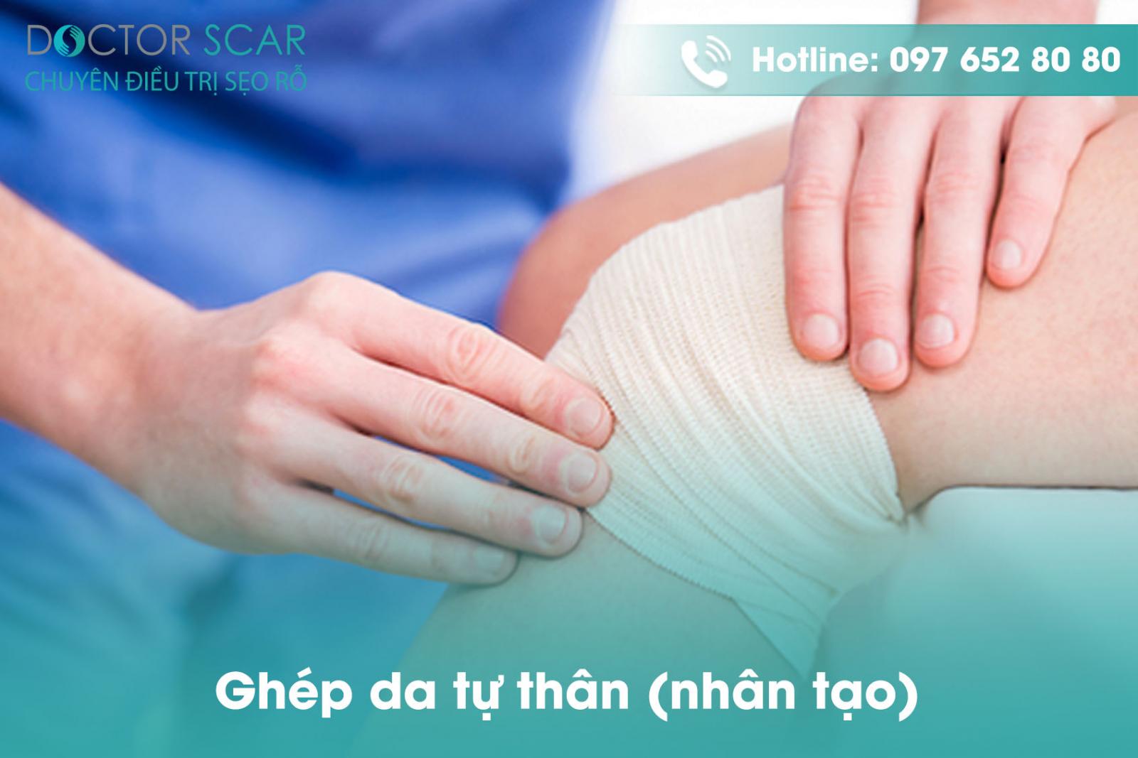 ghep-da-tu-than-nhan-tao Ghép da tự thân (nhân tạo)