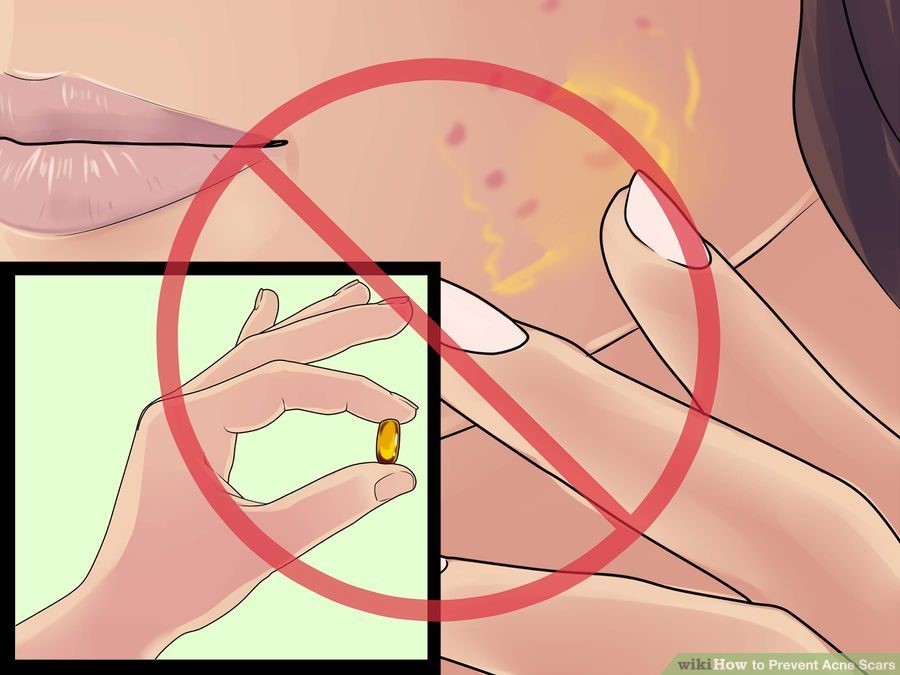 k-su-dung-vitamin-e-truc-tiep1