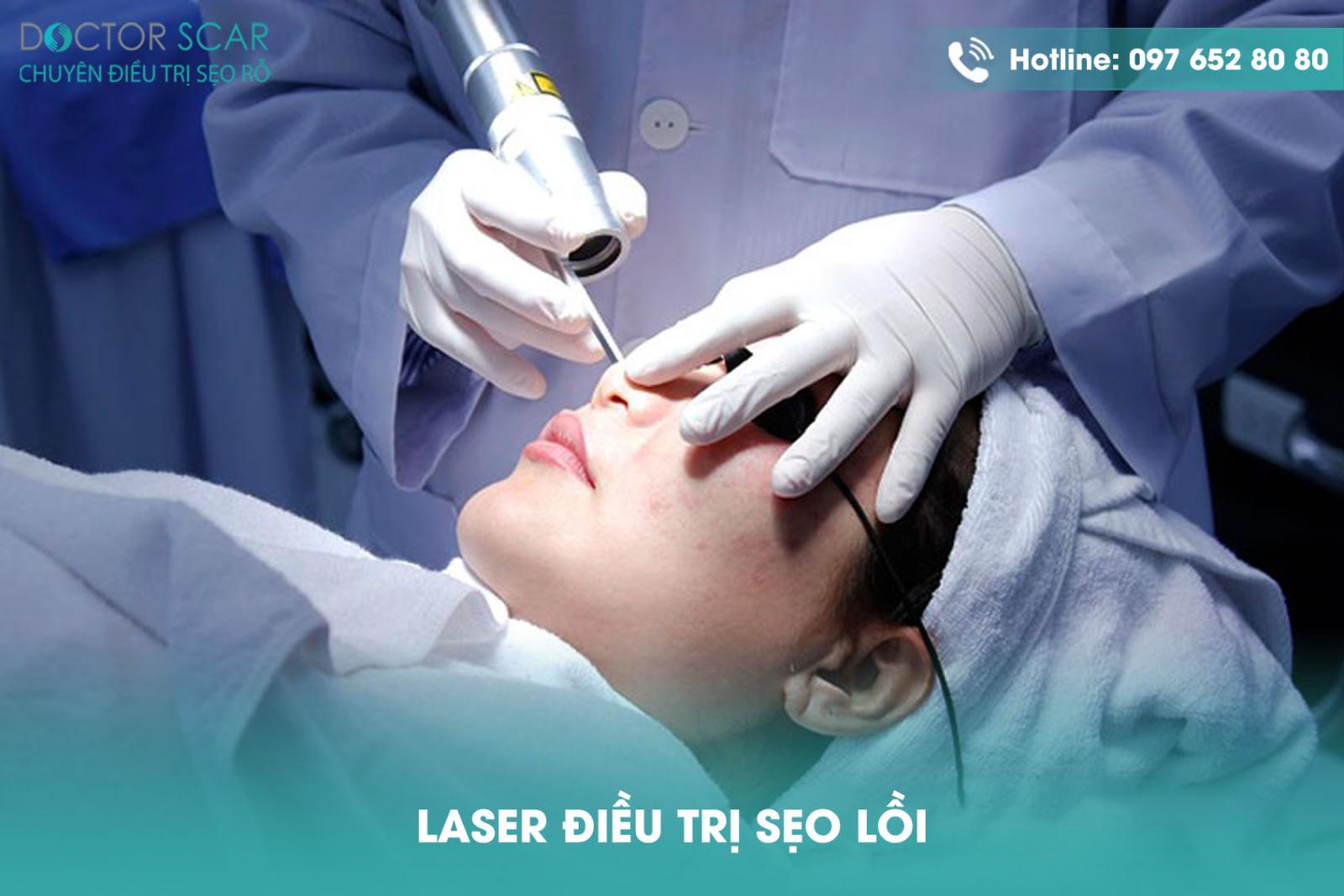 laser-dieu-tri-seo-loi Laser điều trị sẹo lồi