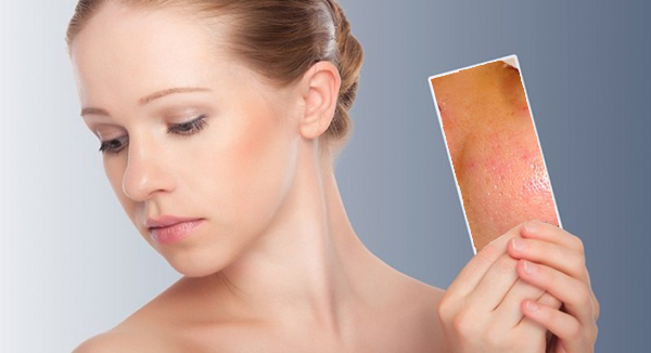 meo_thu_nho_lo_chan_long_da_mat tri-tham-mun