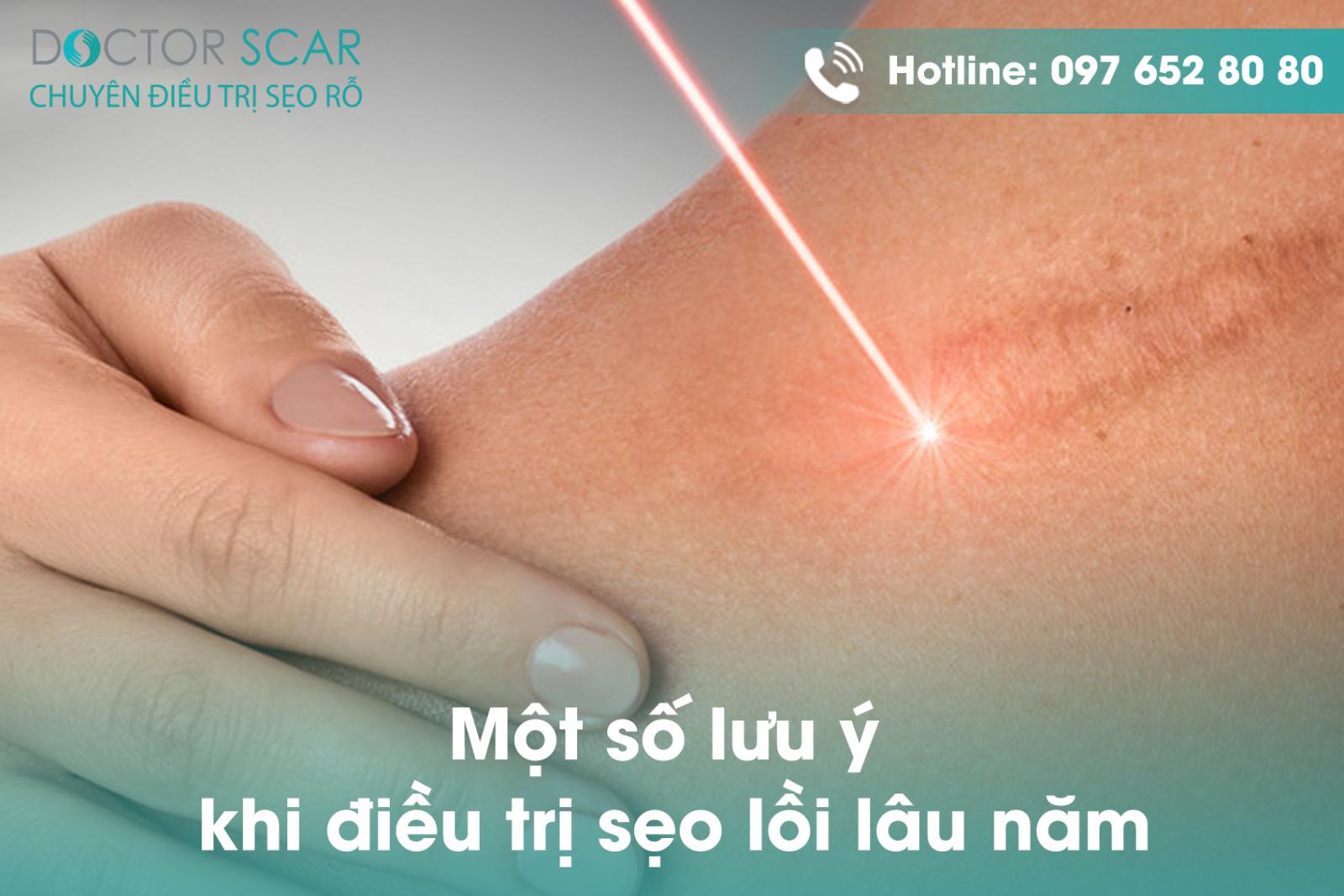 mot-so-luu-y-khi-dieu-tri-seo-loi-lau-nam Một số lưu ý khi điều trị sẹo lồi lâu năm