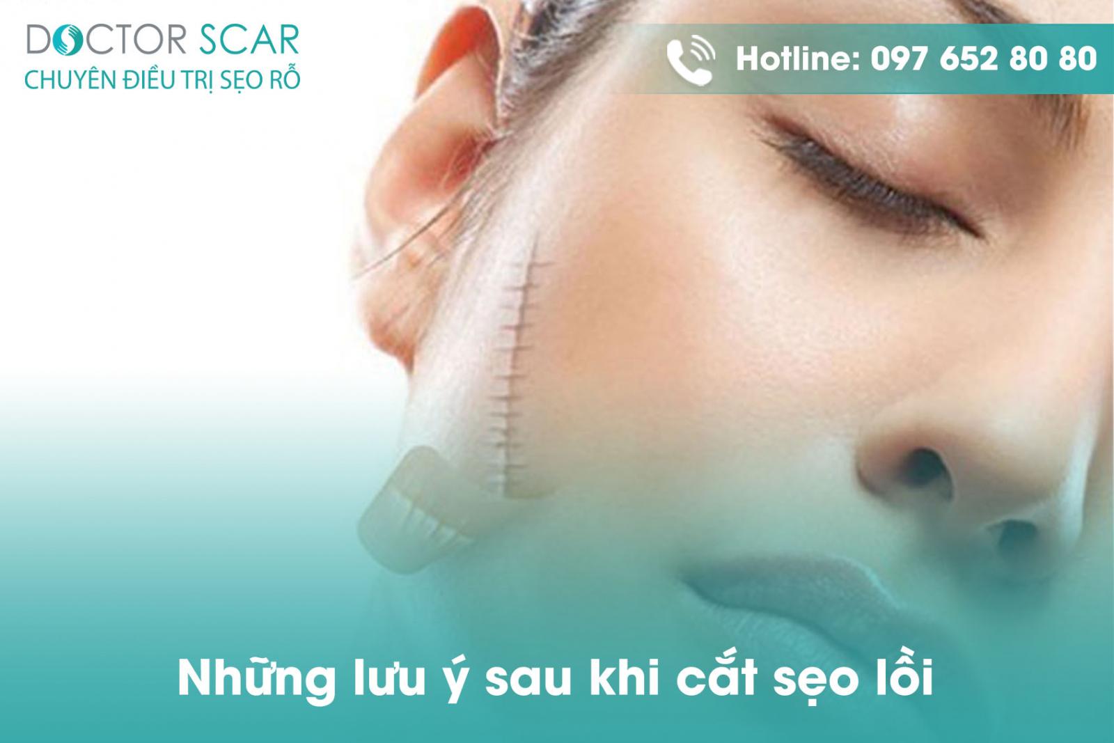 nhung-luu-y-sau-khi-cat-seo-loi Những lưu ý sau khi cắt sẹo lồi