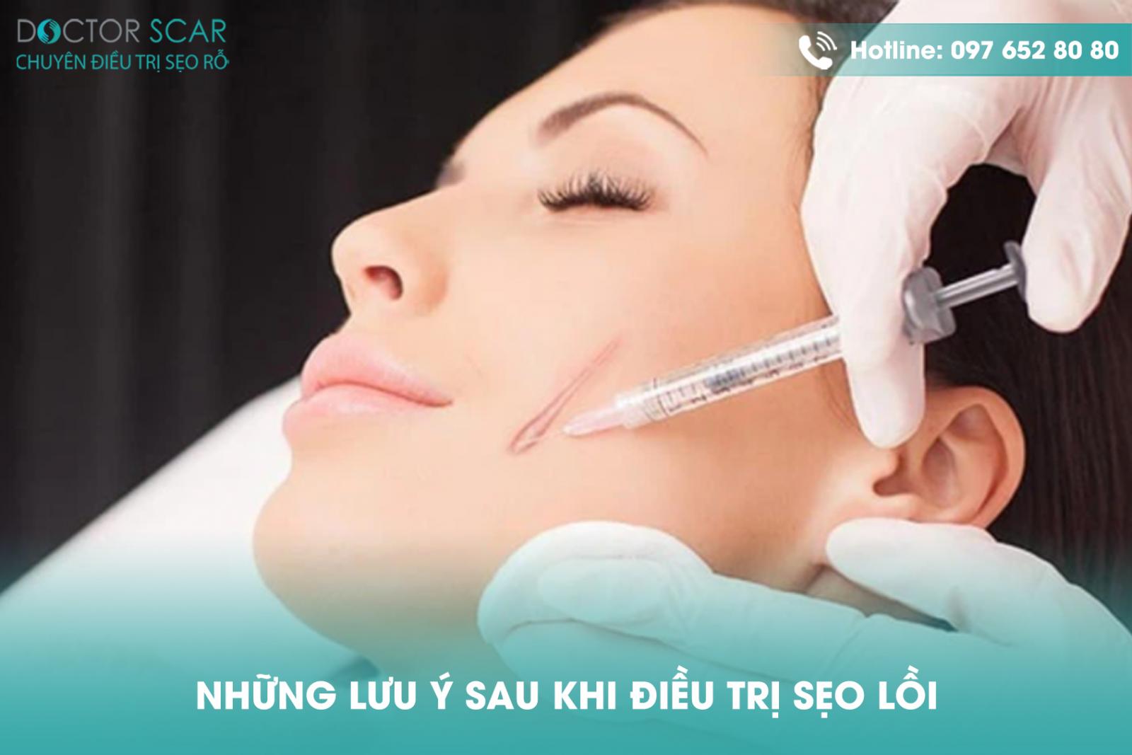 nhung-luu-y-sau-khi-dieu-tri-seo-loi Những lưu ý sau khi điều trị sẹo lồi