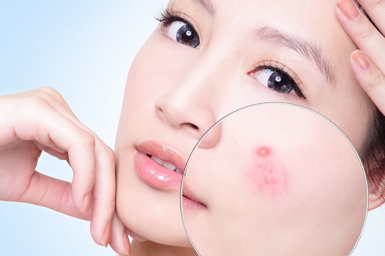 nhung-nguyen-nhan-gay-lo-chan-long-to