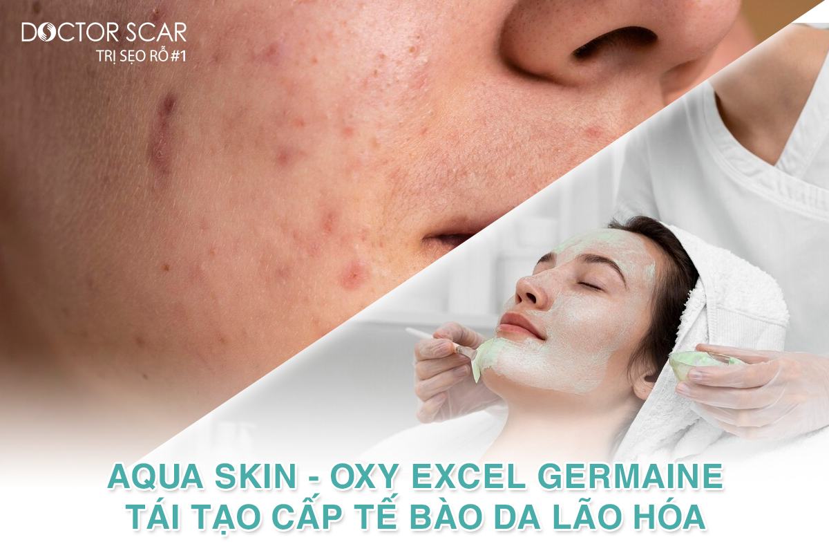 phac-do-aqua-skin-2 aqua skin doctor scar