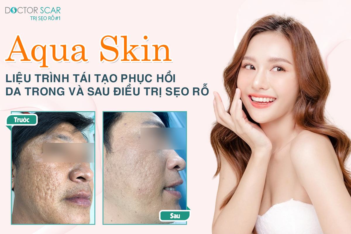 phac-do-aqua-skin-3 aqua skin trong điều trị sẹo rỗ