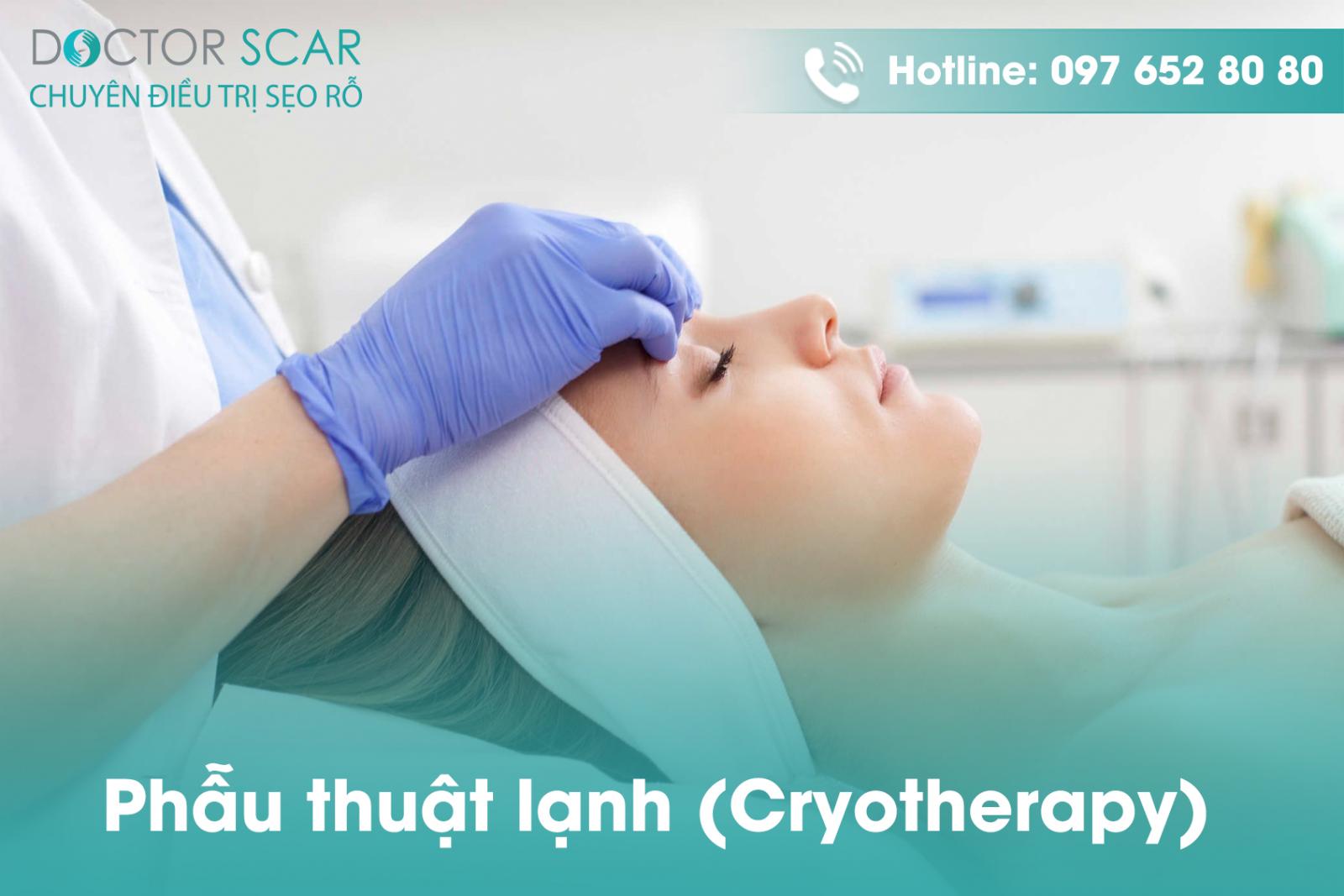 phau-thuat-lanh-cryotherapy-1 Phẫu thuật lạnh (Cryotherapy)