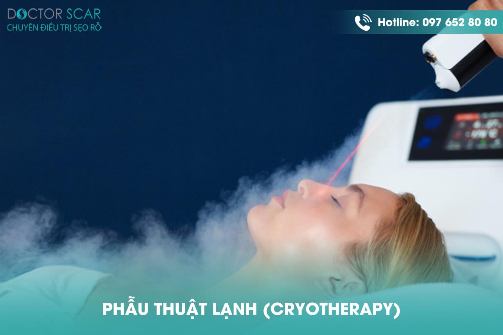 phau-thuat-lanh-cryotherapy Phẫu thuật lạnh (cryotherapy)