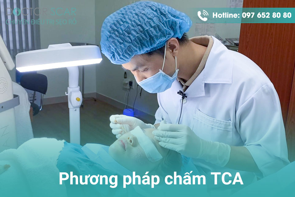 phuong-phap-cham-tca Phương pháp chấm TCA