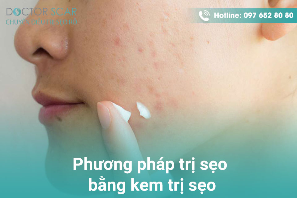 phuong-phap-tri-seo-bang-kem-tri-seo Phương pháp dùng kem trị sẹo.