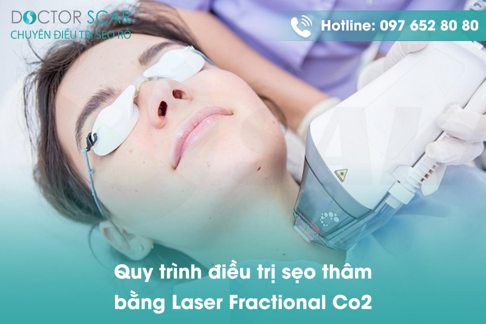 quy-trinh-dieu-tri-seo-tham-bang-laser-fractional-co2 Quy trình điều trị sẹo thâm bằng Laser Fractional CO2.