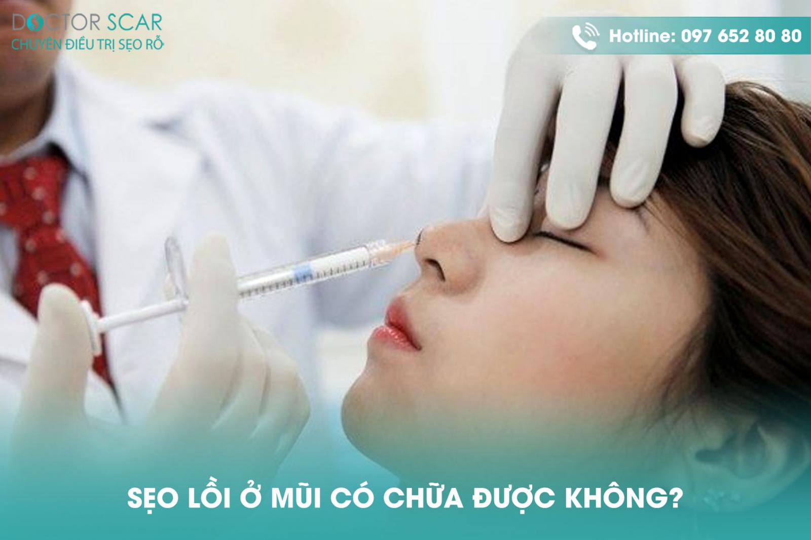 seo-loi-o-mui-co-chua-duoc-khong Sẹo lồi ở mũi có chữa được không?