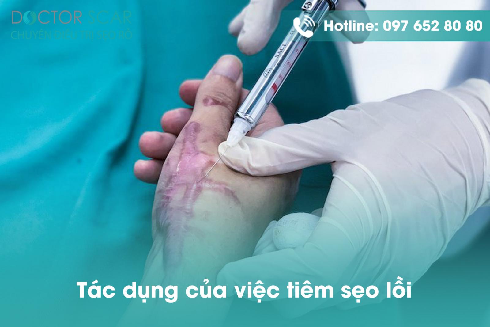 tac-dung-cua-viec-tiem-seo-loi1 Tác dụng của việc tiêm sẹo lồi
