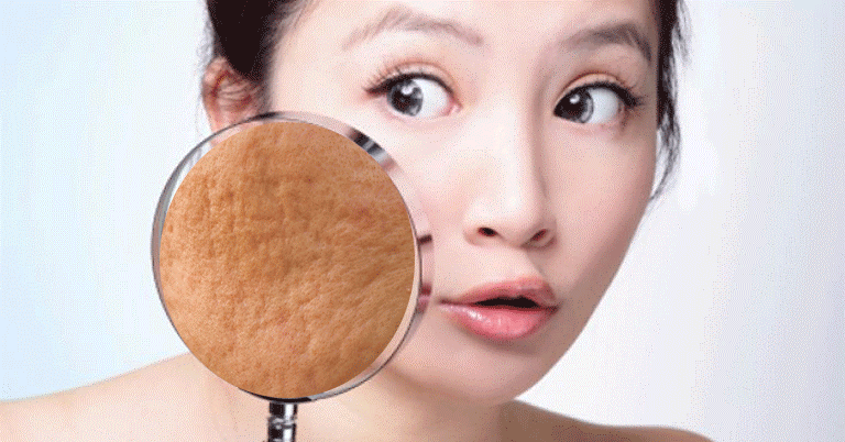 tri-seo-co-dau-khong tri-seo-co-dau-khong