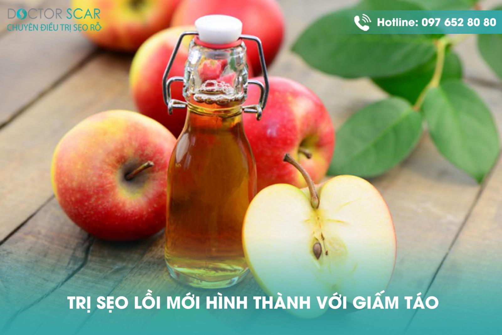 tri-seo-loi-moi-hinh-thanh-voi-giam-tao Trị sẹo lồi mới hình thành với giấm táo