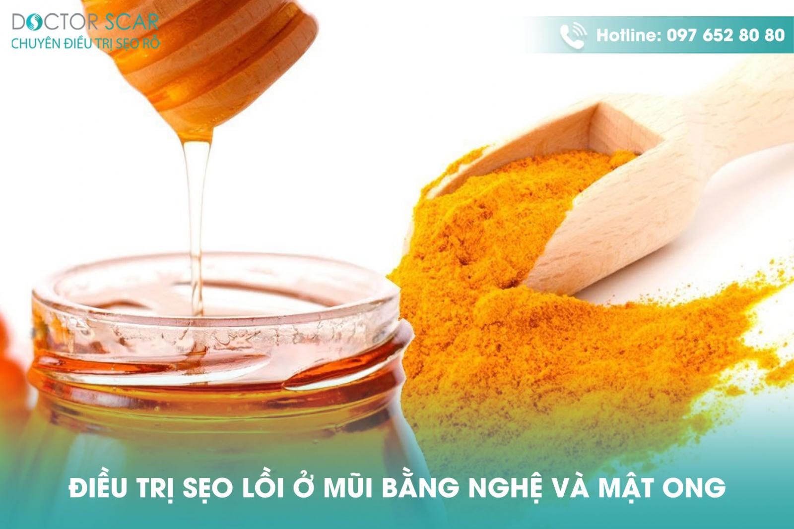 tri-seo-loi-o-mui-bang-nghe-va-mat-ong Trị sẹo lồi ở mũi bằng nghệ và mật ong