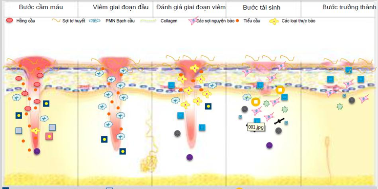 tuoi-tac-anh-huong-nhu-the-nao-den-ket-qua-dieu-tri-seo-ro-1 tuoi-tac-anh-huong-nhu-the-nao-den-ket-qua-dieu-tri-seo-ro-1