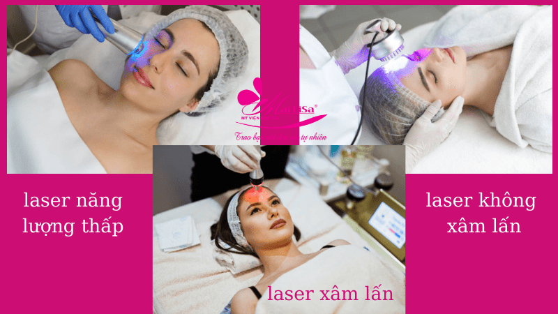 Bảng giá dịch vụ trị thâm mụn ở spa giá bao nhiêu 2022? 2 loại laser chính trong điều trị thẩm mỹ