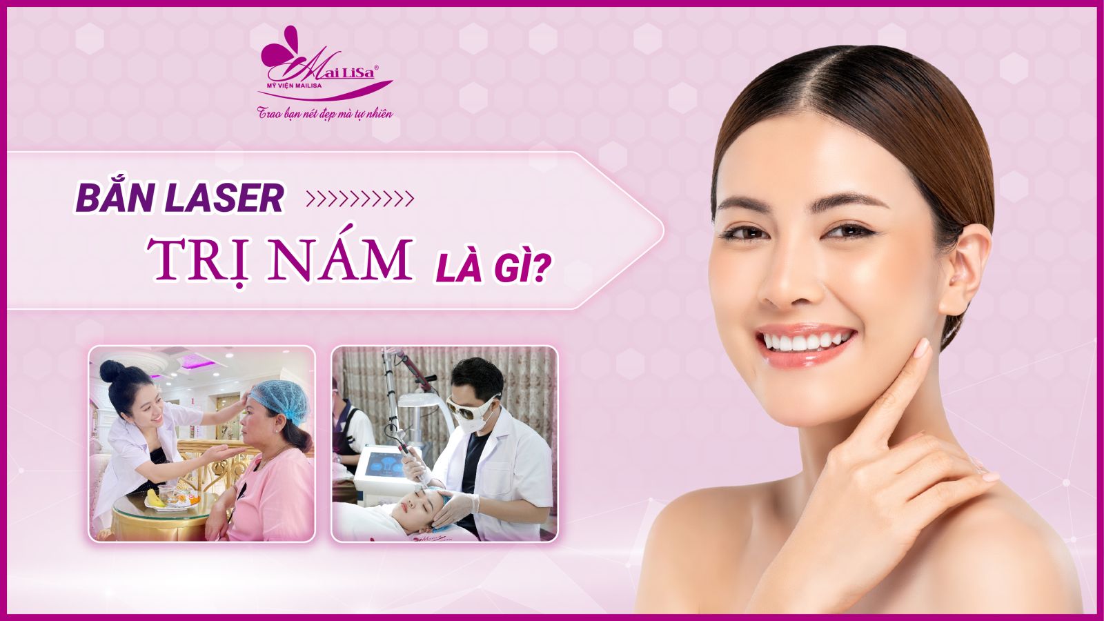 Bắn laser trị nám Whiteskin spectra có tốt không? Chi phí 2023 Bắn laser trị nám Whiteskin spectra có tốt không? Chi phí 2023