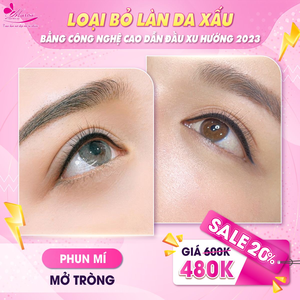 SĂN SALE KHỦNG - NHẬN QUÀ TO mừng ngày 8 tháng 3 tại Mailisa phun mí mở tròng