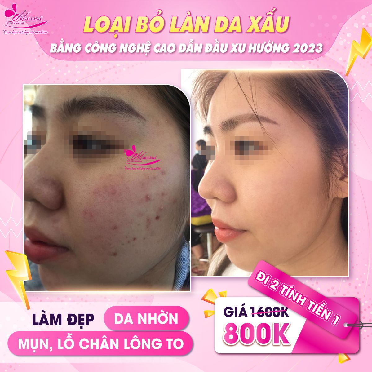 SĂN SALE KHỦNG - NHẬN QUÀ TO mừng ngày 8 tháng 3 tại Mailisa da mụn