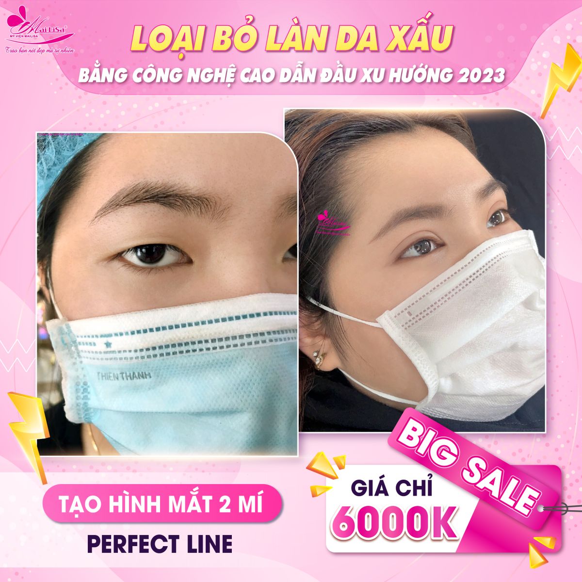 SĂN SALE KHỦNG - NHẬN QUÀ TO mừng ngày 8 tháng 3 tại Mailisa mắt 2 mí