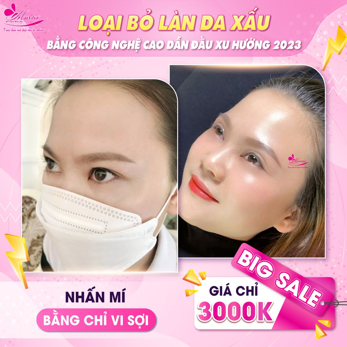 SĂN SALE KHỦNG - NHẬN QUÀ TO mừng ngày 8 tháng 3 tại Mailisa nhấn mí