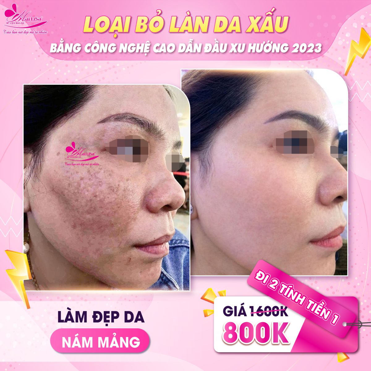 SĂN SALE KHỦNG - NHẬN QUÀ TO mừng ngày 8 tháng 3 tại Mailisa da nám