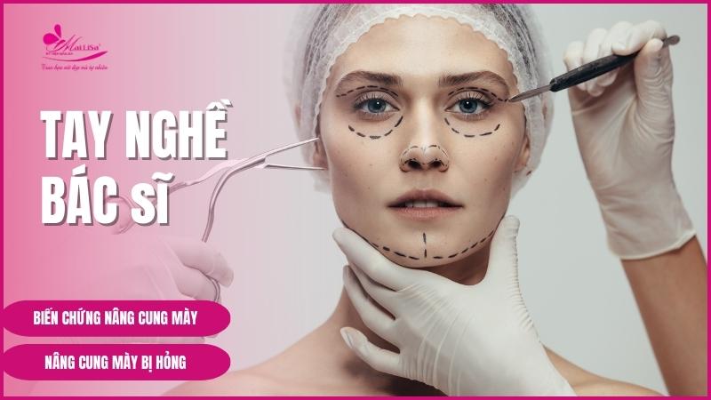 Biến chứng nghiêm trọng nâng cung mày bị hỏng 2023 Hình ảnh trước và sau khi treo chân mày