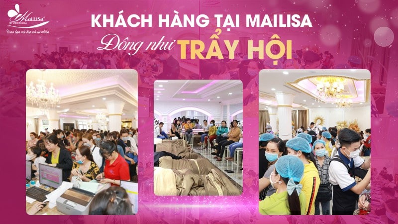 Lấy mỡ mí mắt trên bao nhiêu tiền? Dịch vụ ở đâu tốt 4 - 4 lấy mỡ mí mắt trên bao nhiêu tiền boc mo mat