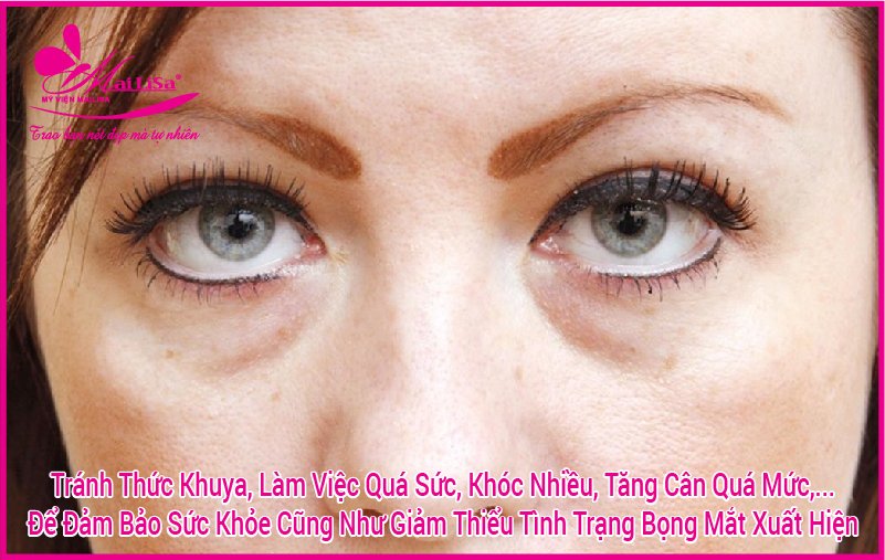 Người có bọng mắt to đẹp hay xấu? tướng số có tốt không? tướng mắt có bọng