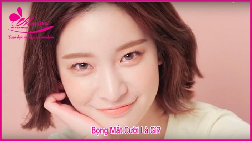 Người có bọng mắt to đẹp hay xấu? tướng số có tốt không? bọng mắt to khi cười