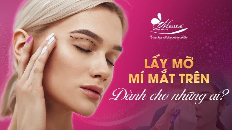 Có nên lấy mỡ mí mắt nội soi không và những điều cần tránh 4 - 4 lấy mỡ mí mắt nội soi lấy mỡ mí mắt nội soi