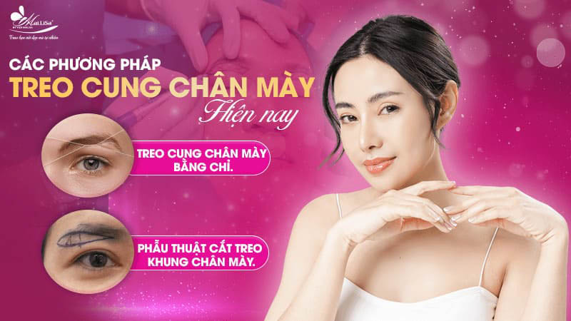 Treo chân mày là gì và có những phương pháp nào năm 2024 4 - 4 treo chân mày treo cung chân mày