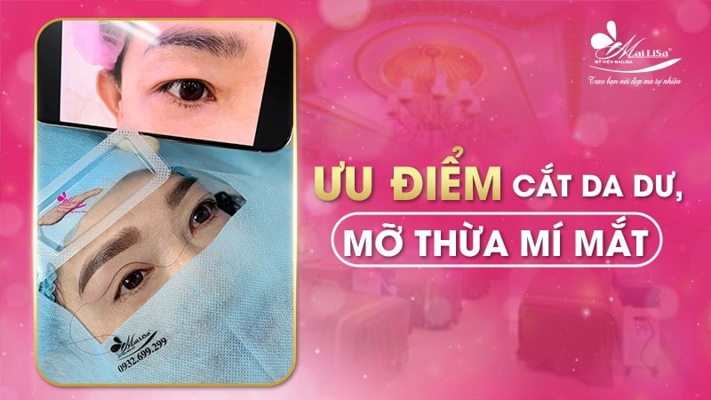 Có nên lấy mỡ mí mắt nội soi không và những điều cần tránh 5 - 5 lấy mỡ mí mắt nội soi lấy mỡ mí mắt nội soi