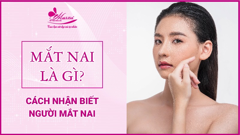 Mắt nai là gì? Tướng số người mắt nai sẽ như thế nào Cách nhận biết người mắt nai