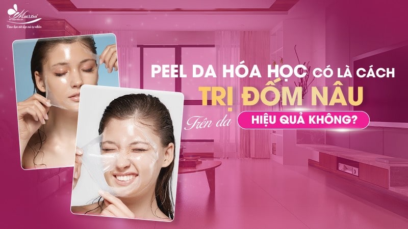 8 Cách trị đốm nâu trên mặt thịnh hành hiện nay 13 - 13 đốm nâu trên mặt cach tri dom nau tren mat tai nha