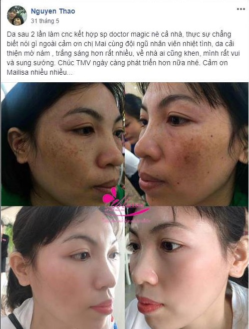 Mỹ Phẩm Doctor Magic có phải kem trộn không? kem chống nắng doctor magic có tốt không