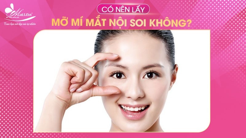 Có nên lấy mỡ mí mắt nội soi không và những điều cần tránh 1 - 1 lấy mỡ mí mắt nội soi lấy mỡ mí mắt nội soi