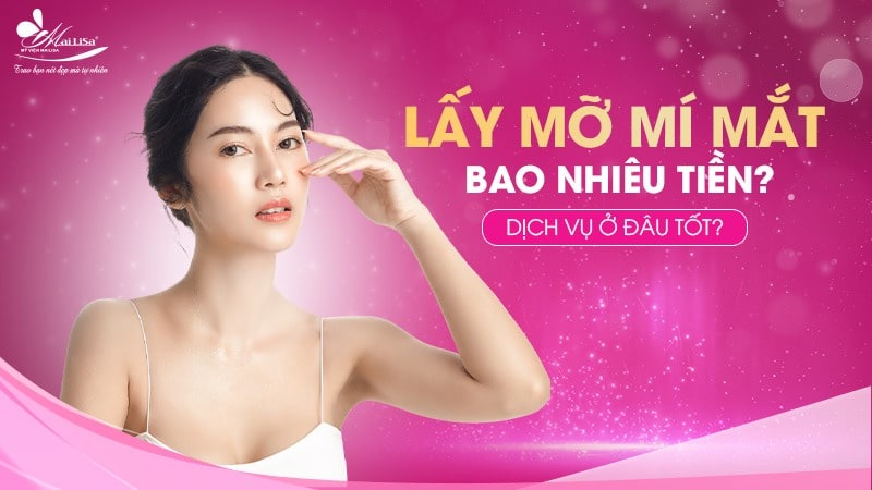Lấy mỡ mí mắt trên bao nhiêu tiền? Dịch vụ ở đâu tốt 1 - 1 lấy mỡ mí mắt trên bao nhiêu tiền Lấy mỡ mí mắt trên bao nhiêu tiền